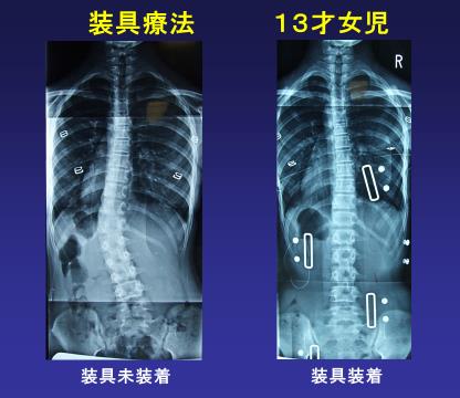 側弯症外来 診療科目一覧 大田区蒲田 牧田総合病院 社会医療法人財団 仁医会