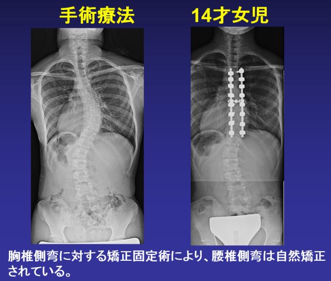 側弯症外来 診療科目一覧 大田区蒲田 牧田総合病院 社会医療法人財団 仁医会 側弯症外来 診療科目一覧 大田区蒲田 牧田総合病院 社会医療法人財団 仁医会