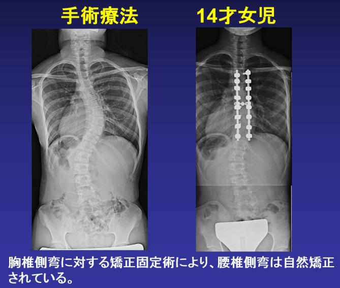 側弯症外来 診療科目一覧 大田区蒲田 牧田総合病院 社会医療法人財団 仁医会